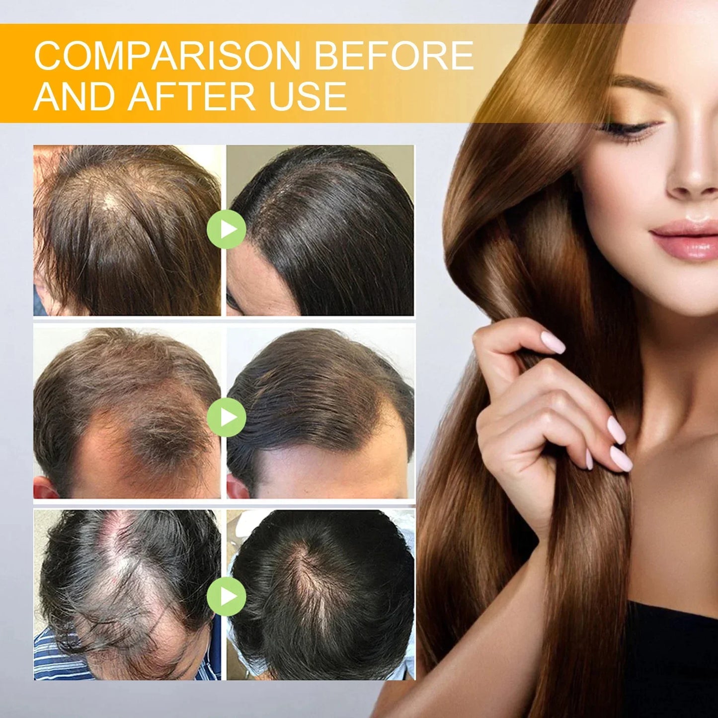 Biotin Anti Hair Loss Serum - Spray