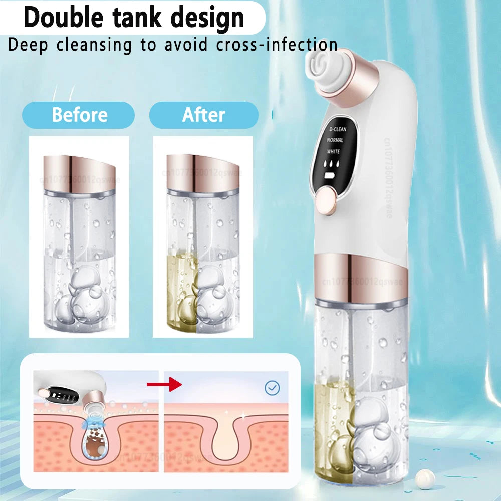 Electric Blackhead Remover Pore Vacuum – USB Rechargeable Face Cleaner for Acne & Blackhead Removal