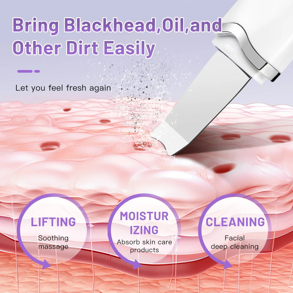 Electric Ultrasonic Skin Scrubber – Facial Spatula for Blackhead Removal, Peeling & Lifting Cleansing