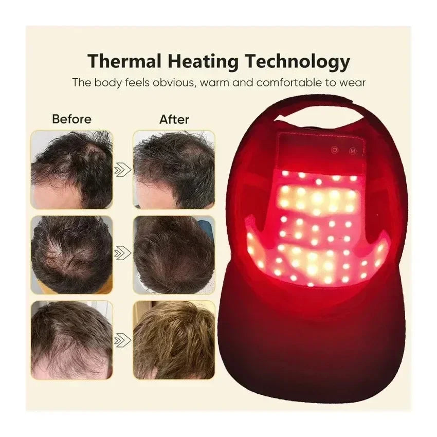 LED Red Light Therapy Cap – Laser Hair Growth Helmet for Hair Regrowth & Hair Loss Treatment