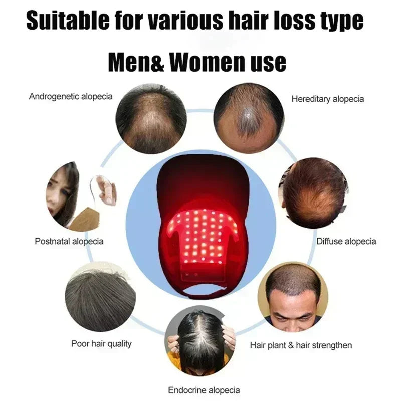 LED Red Light Therapy Cap – Laser Hair Growth Helmet for Hair Regrowth & Hair Loss Treatment