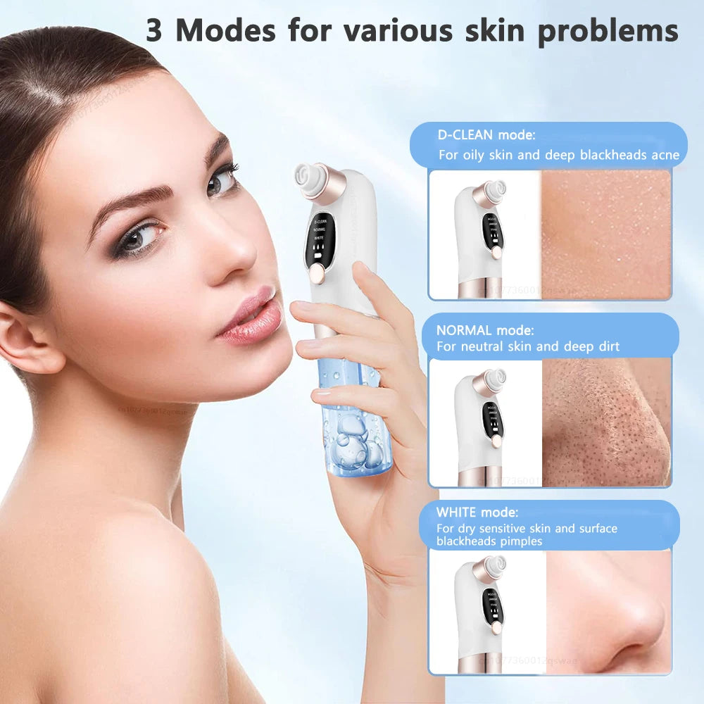 Electric Blackhead Remover Pore Vacuum – USB Rechargeable Face Cleaner for Acne & Blackhead Removal