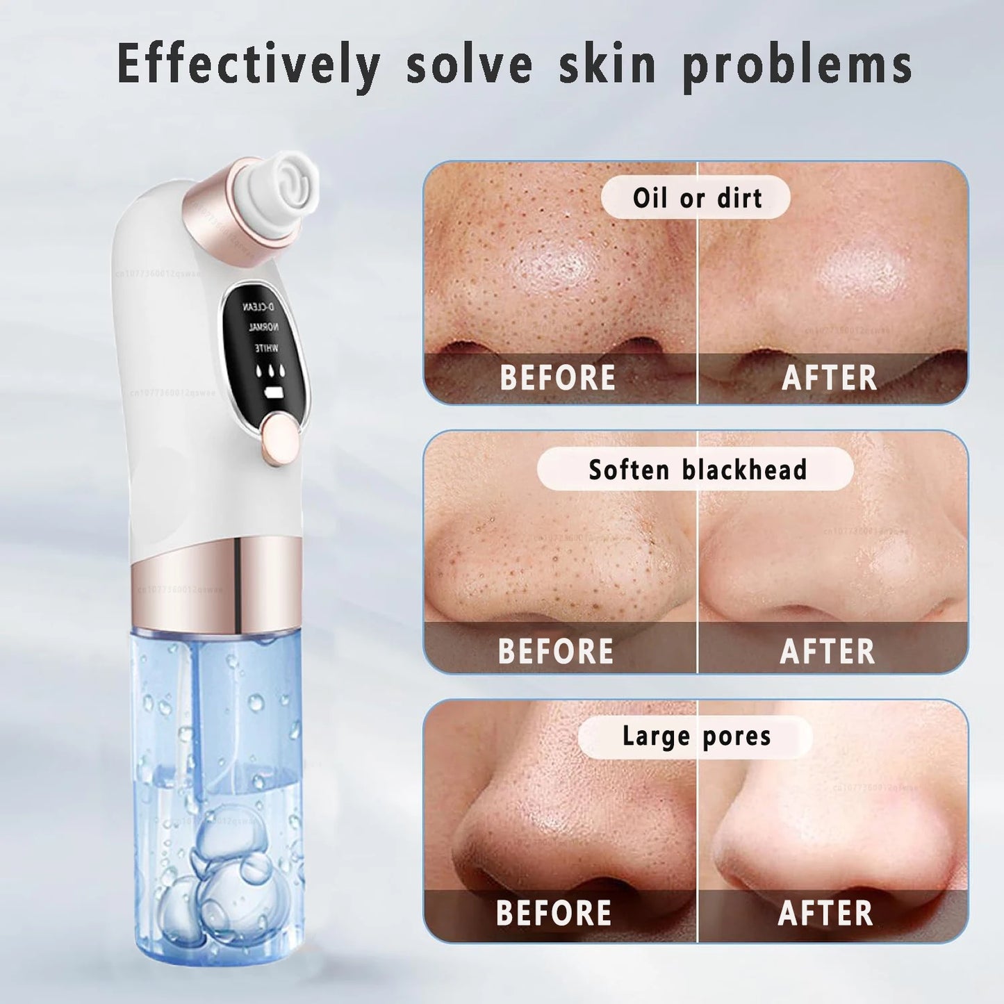 Electric Blackhead Remover Pore Vacuum – USB Rechargeable Face Cleaner for Acne & Blackhead Removal