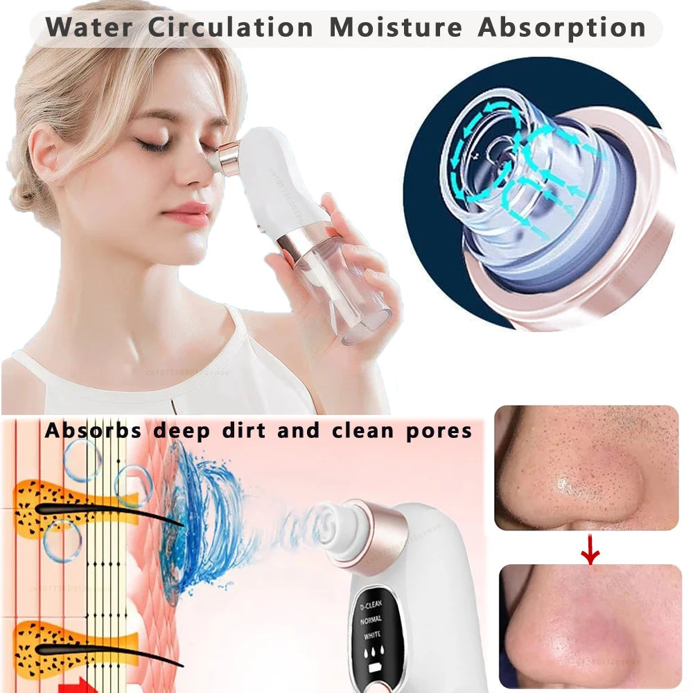 Electric Blackhead Remover Pore Vacuum – USB Rechargeable Face Cleaner for Acne & Blackhead Removal