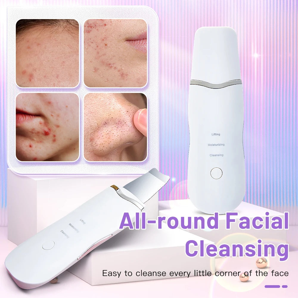 Electric Ultrasonic Skin Scrubber – Facial Spatula for Blackhead Removal, Peeling & Lifting Cleansing