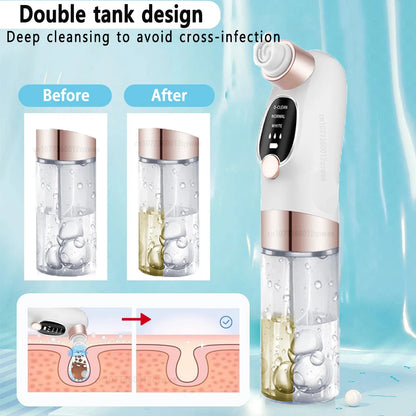 Electric Blackhead Remover Pore Vacuum – USB Rechargeable Face Cleaner for Acne & Blackhead Removal
