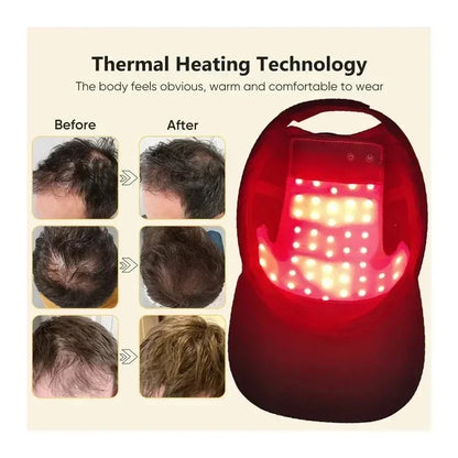 LED Red Light Therapy Cap – Laser Hair Growth Helmet for Hair Regrowth & Hair Loss Treatment