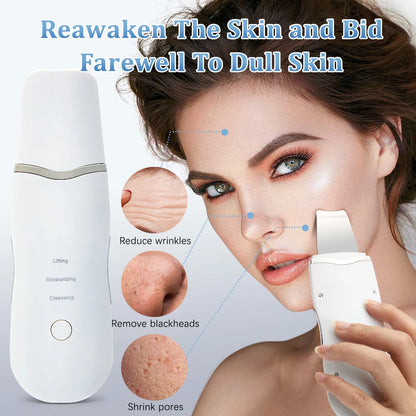 Electric Ultrasonic Skin Scrubber – Facial Spatula for Blackhead Removal, Peeling & Lifting Cleansing