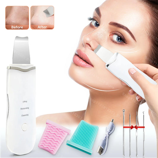 Electric Ultrasonic Skin Scrubber – Facial Spatula for Blackhead Removal, Peeling & Lifting Cleansing