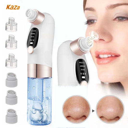 Electric Blackhead Remover Pore Vacuum – USB Rechargeable Face Cleaner for Acne & Blackhead Removal