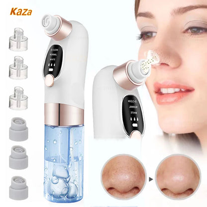 Electric Blackhead Remover Pore Vacuum – USB Rechargeable Face Cleaner for Acne & Blackhead Removal