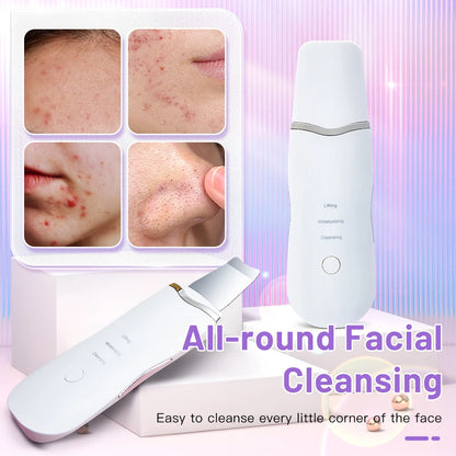 Electric Ultrasonic Skin Scrubber – Facial Spatula for Blackhead Removal, Peeling & Lifting Cleansing